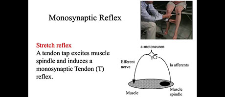 screenshhot from NIMH video: Dr. Zhen Ni – Cortical Anatomy and Clinical Neurophysiology